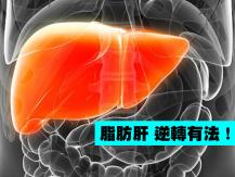 Fatty liver 很多人有脂肪肝而不自知 逆轉有法！