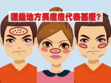 Pimples 這 9 個部位長痘痘 是身體給你的健康警號！