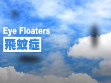 Eye floaters 為甚麼會有飛蚊症？何時需要求醫？