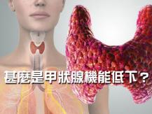 Hypothyroidism 容易疲勞 臉部浮腫 皮膚又乾燥 可能是甲狀腺出了問題