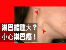 Lymph nodes 淋巴系統出毛病有甚麼徵兆？