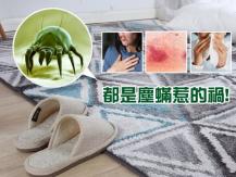 Dust mite allergy 家中肉眼看不見的小動物 原來是讓你過敏的元兇