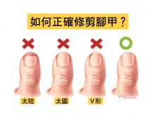 Toenails 如何正確修剪腳甲？