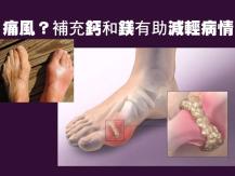 Gout 痛風不一定因為尿酸高  補充鈣和鎂減輕病情