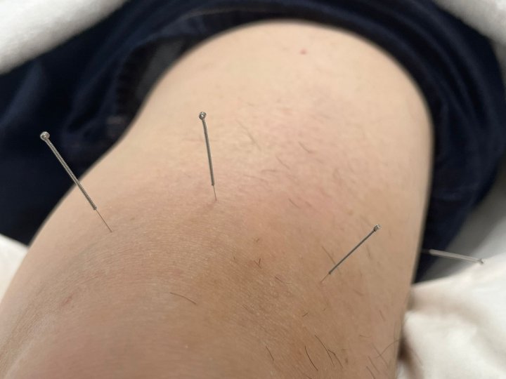 本省中醫監管當局新規例據報未包括中藥處方須由合資格專業人士執行引議