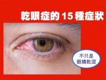 Dry Eye Syndrome 乾眼症的 15 種症狀