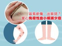Bruises 小孩常瘀青、點狀出血 當心免疫性血小板減少症