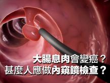 Colon 大腸息肉會變癌？甚麼人應做內窺鏡檢查？ 