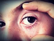 Cataracts 人到中年突然視力改善？可能是白內障先兆