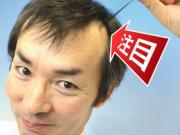 Hair Loss 還在為脫髮煩惱嗎？簡單幾招還你濃密頭髮