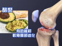 Arthritis 走路卡卡骨關節炎痛！研究：酪梨是「護膝糧食」